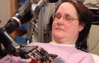 La donna paralizzata che controlla il braccio bionico col pensiero
